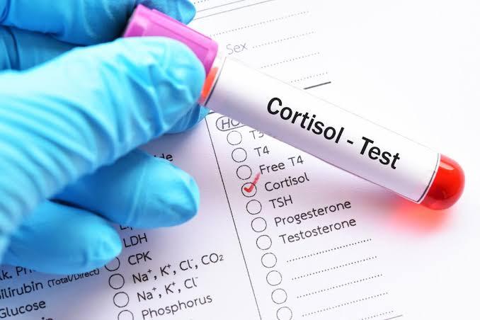 Is high cortisol a problem