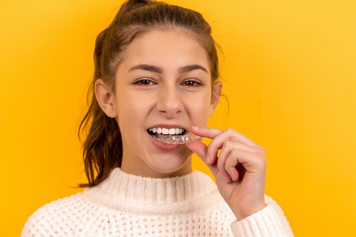 Orthodontic braces are not a one-size-fits-all solution